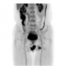 First whole-human scan by simultaneous PET and CT
